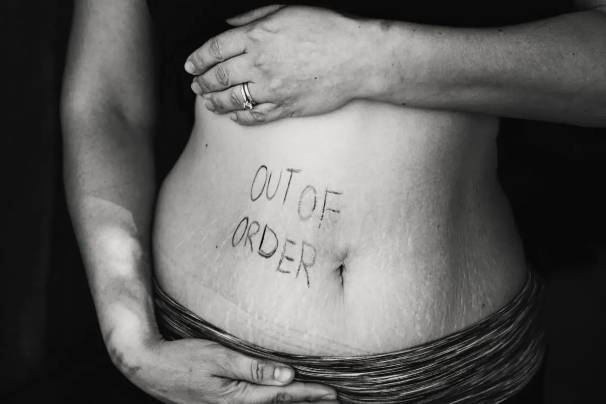 Black and white picture of a person framing their bare stomach with their hands. Words are written on the stomach that say "out of order".